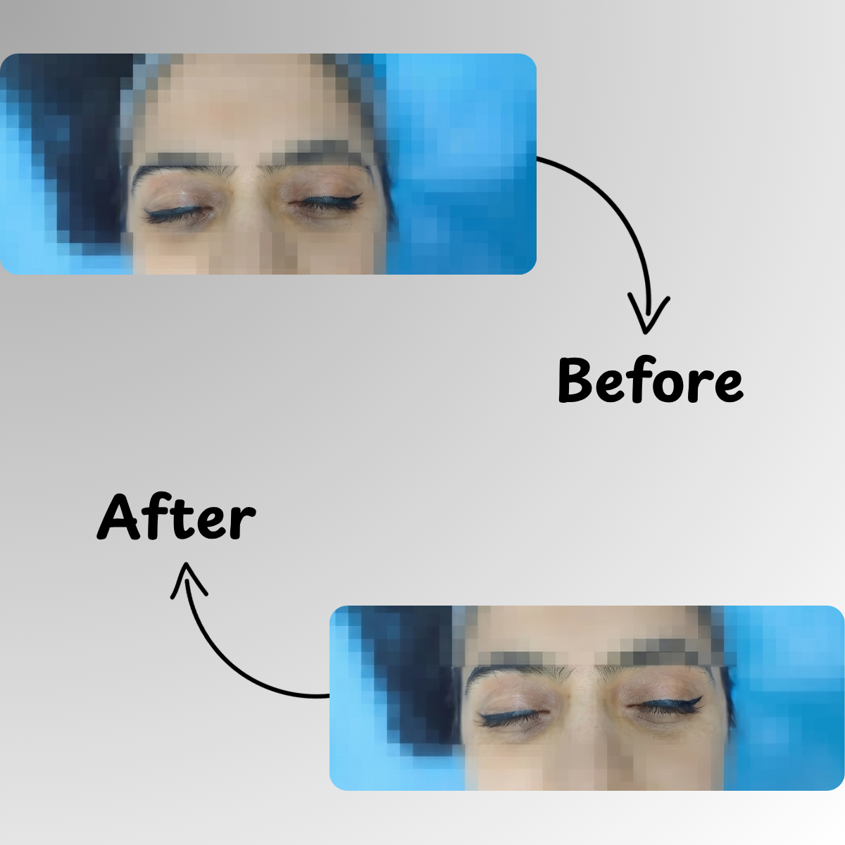 Under Eye Brightening